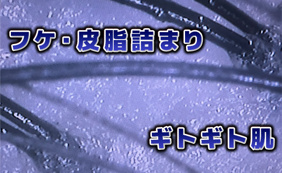 シャンプーするたび、ため息…。一人で悩まないで